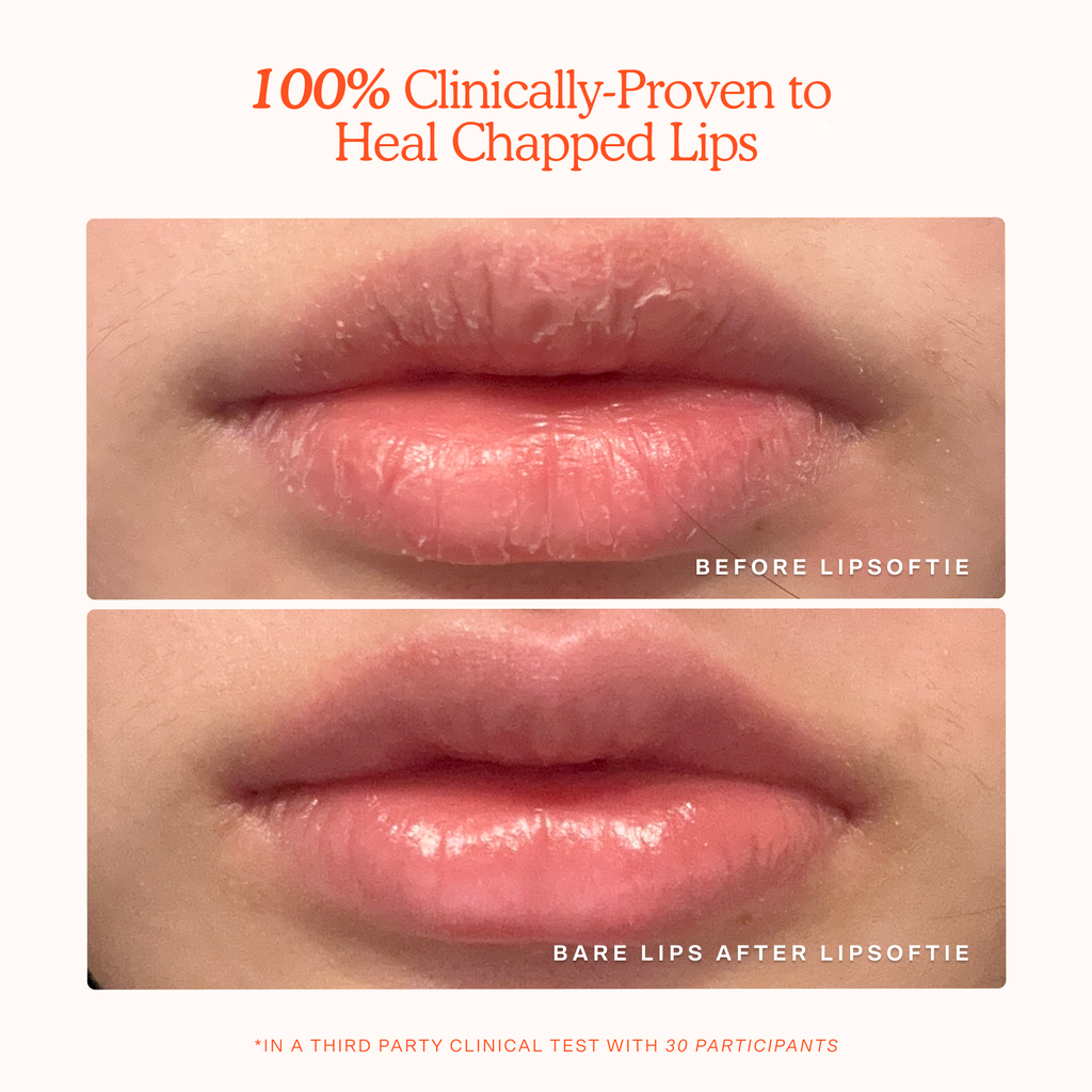 Tower 28 LipSoftie® Lip Treatment