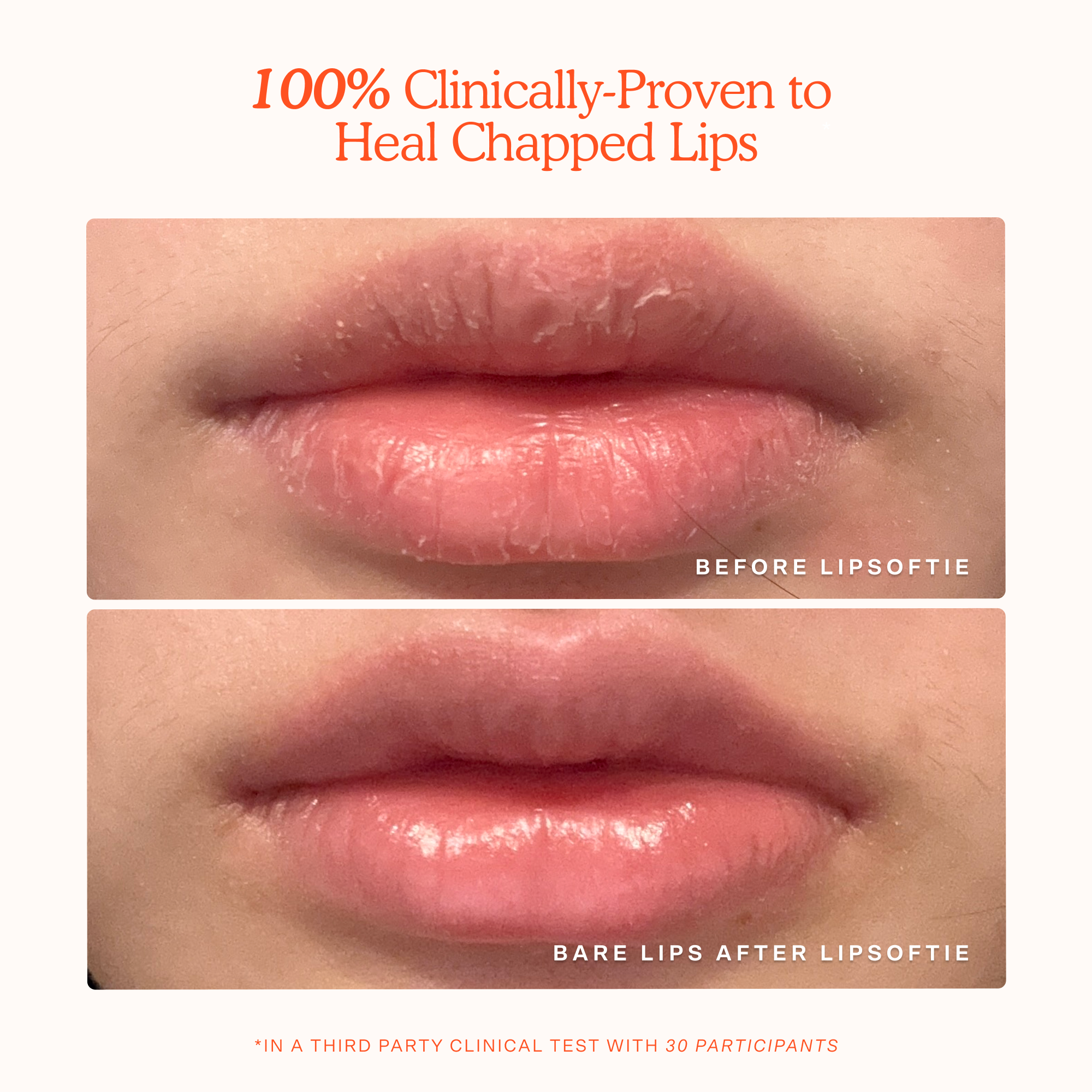 Tower 28 LipSoftie® Lip Treatment