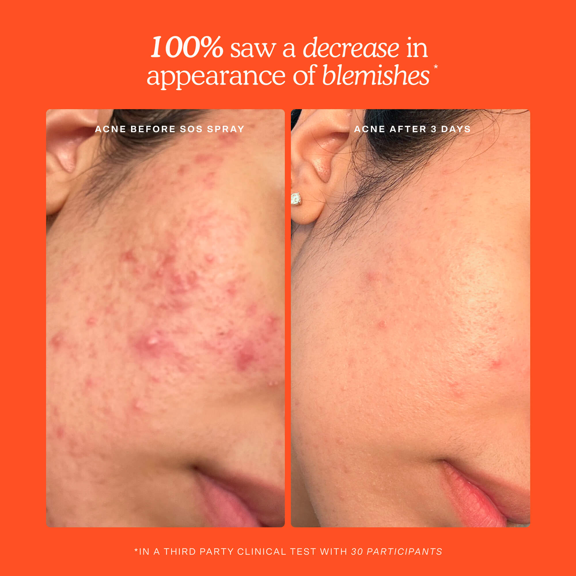 Tower 28 SOS Skincare Minis Kit