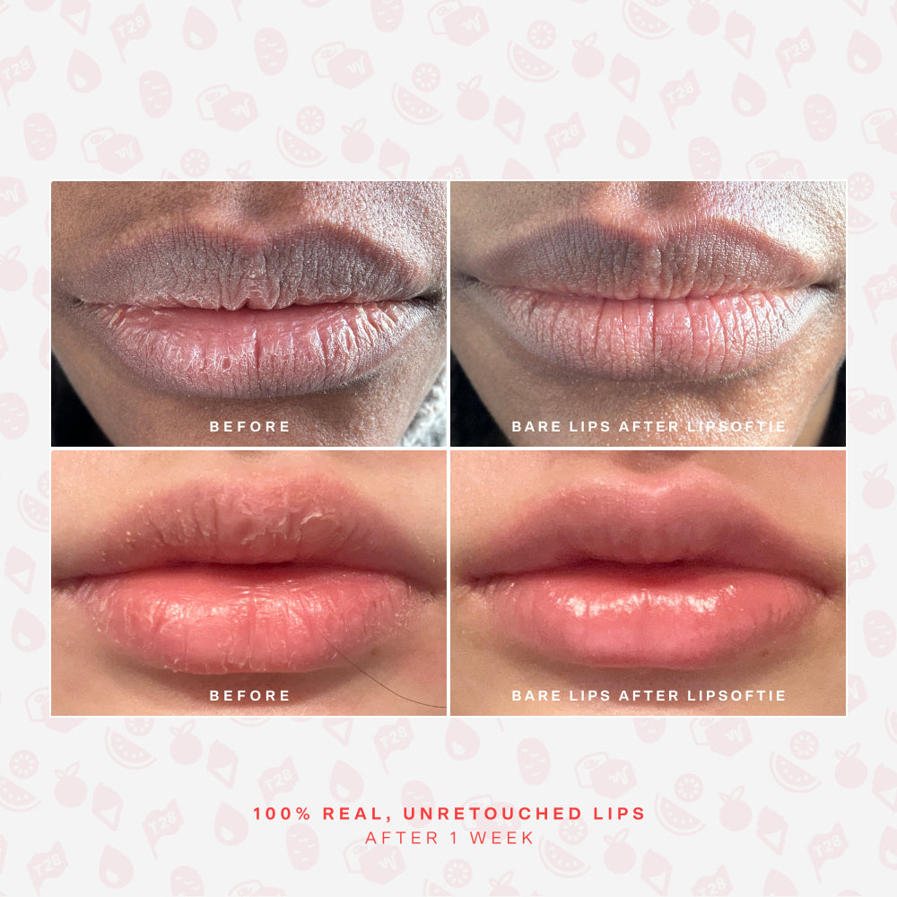 Tower 28 SOS LipSoftie® Lip Treatment