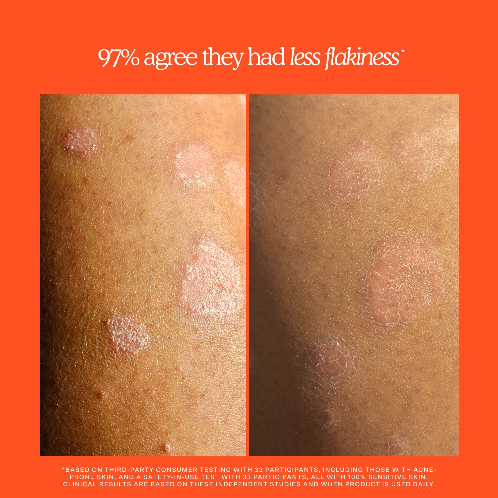 Tower 28 SOS Rescue + Relief Body Wash Treatment
