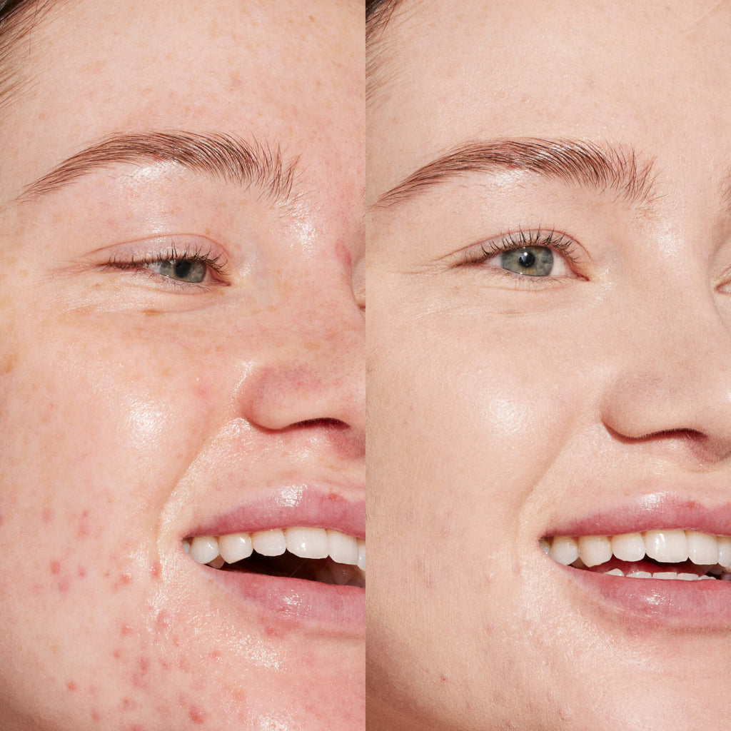 Tower 28 Swipe Serum Concealer®